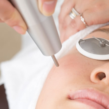 加齢とともに目立つ肝斑