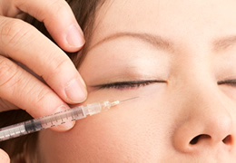 ヒアルロン酸注入